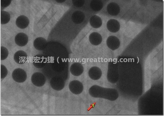 BGA因為焊墊變小，造成錫膏過多而最終形成焊接短路的結(jié)果。